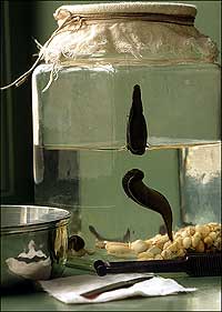 Leeches in a jar