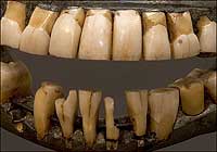 George Washington's dentures